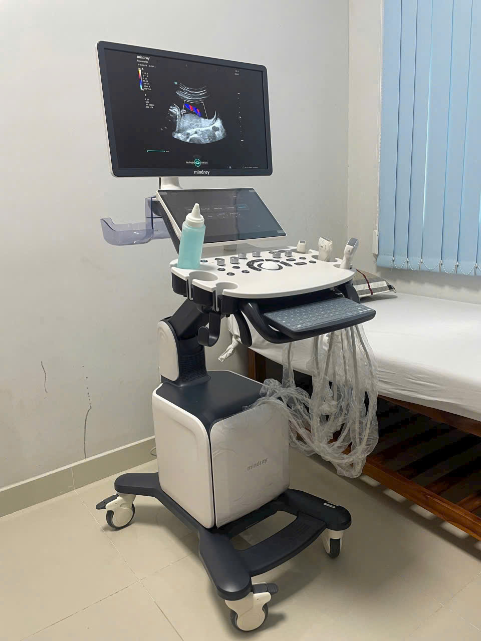 Các mức giá máy siêu âm màu phổ biến trên thị trường hiện nay